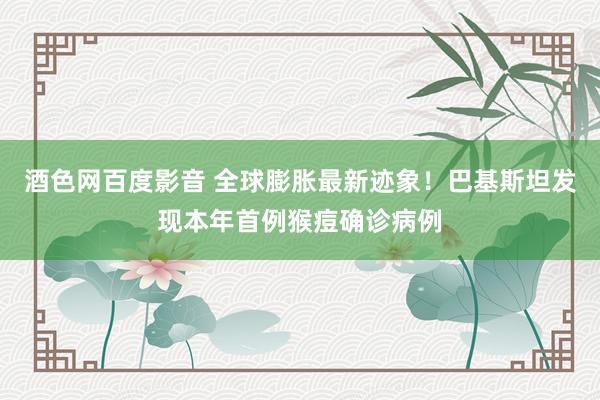 酒色网百度影音 全球膨胀最新迹象！巴基斯坦发现本年首例猴痘确诊病例